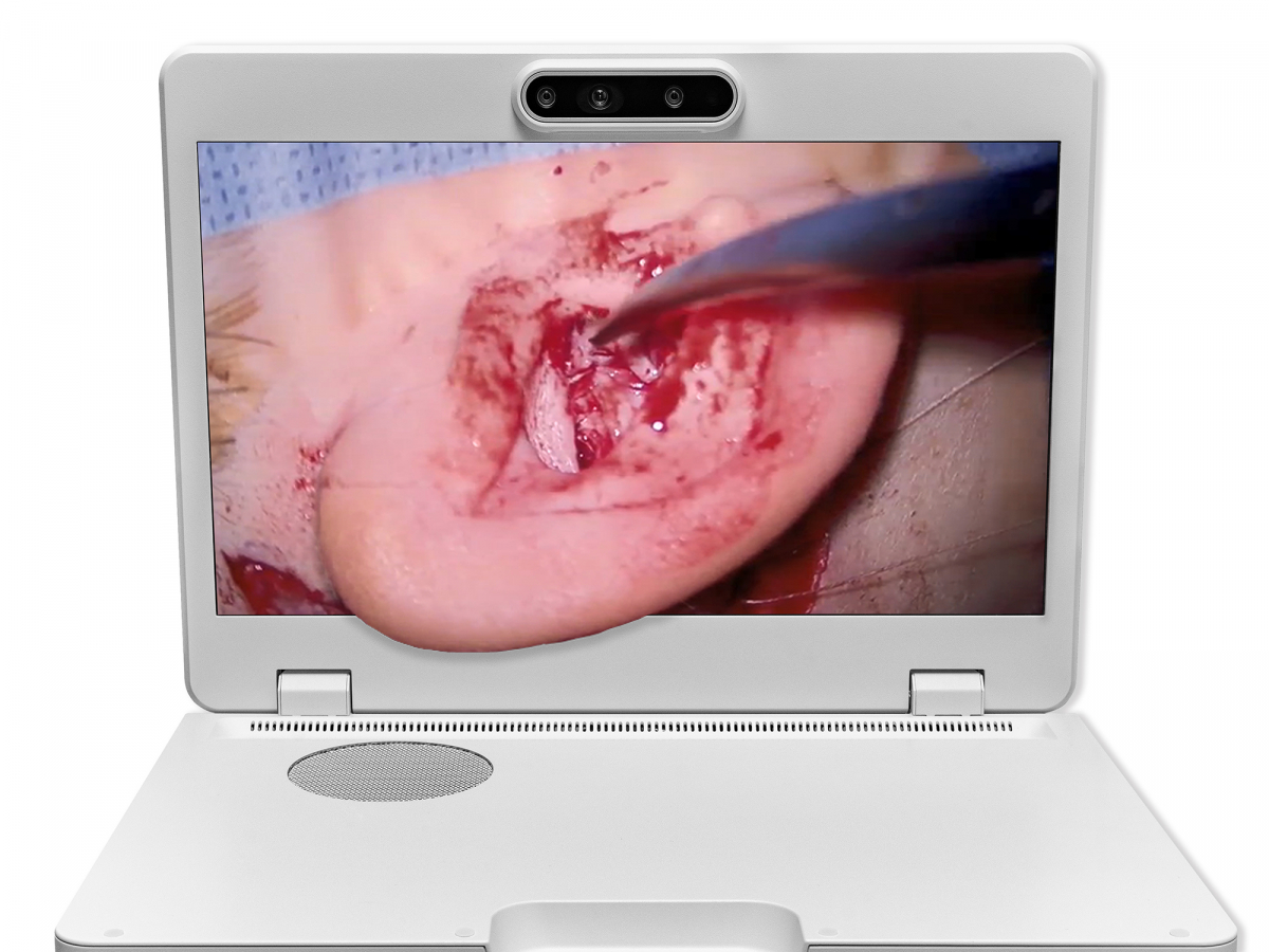 達擎之＂Heads-up 3D顯微手術(shù)顯示系統(tǒng)＂，整合4K裸眼3D顯示及眼球追蹤系統(tǒng)，具備快速追蹤人眼移動位置功能，減輕醫(yī)師長時間維持固定姿勢的負擔，讓醫(yī)師能有更寬廣清晰的3D立體視野及更舒適的姿勢來執(zhí)行手術(shù)。